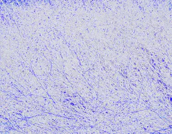 Content Dam Ww Online Articles 2018 09 Membrane Blue Content Dam Ww Online Articles 2018 09 Membrane Blue