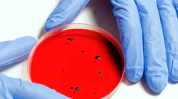 Sewage surveillance has a major role to play in tracking and understanding coronavirus outbreaks. Sewage surveillance has a major role to play in tracking and understanding coronavirus outbreaks.