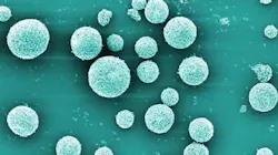 Ceramic granules made of aluminum oxide were coated with a nanometer-thin layer of copper oxide, as shown here at 5,000-fold magnification (electron microscopy, colored). Ceramic granules made of aluminum oxide were coated with a nanometer-thin layer of copper oxide, as shown here at 5,000-fold magnification (electron microscopy, colored).