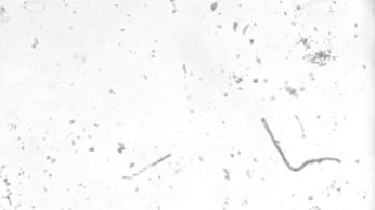 Movement of Paramecium at 1x & 5x permissible limit concentrations of volatile organic compounds (VOCs) water pollutants.
