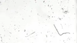 Movement of Paramecium at 1x & 5x permissible limit concentrations of volatile organic compounds (VOCs) water pollutants. Movement of Paramecium at 1x & 5x permissible limit concentrations of volatile organic compounds (VOCs) water pollutants.